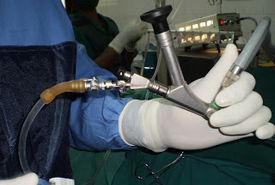 kidney stones audit pcnl surgical outcomes baus percutaneous ureter nephrolithotomy removal keyhole upper published july